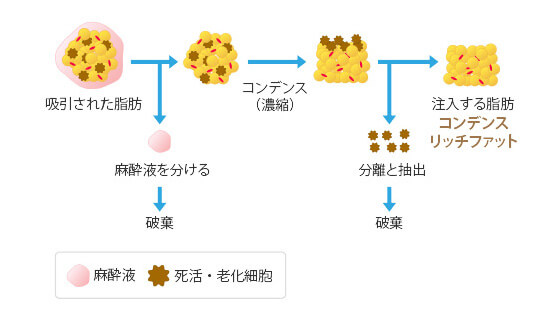 ベイザーリポのイメージ