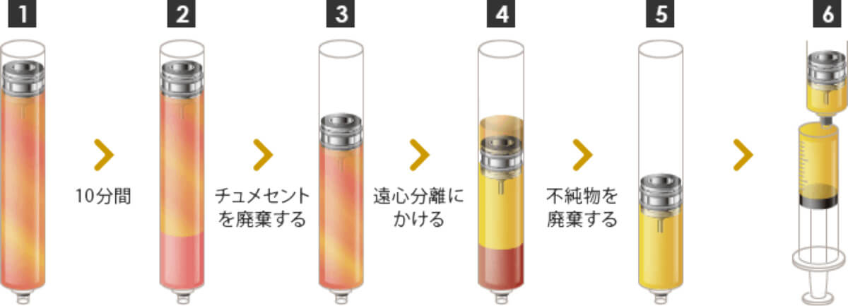 コンデンスリッチ豊胸抽出イメージ