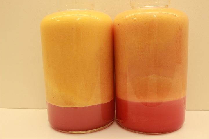 １０月スタート　　吸引した脂肪の紹介