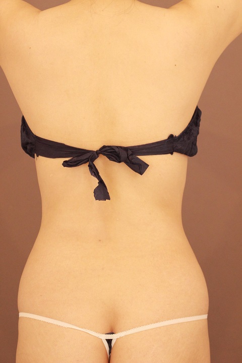 全腹部・腰　１か月経過