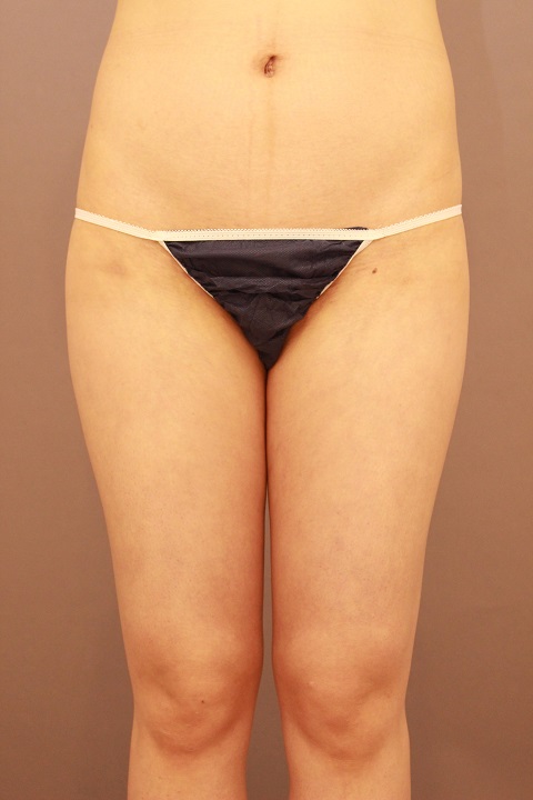 １か月後でまだ変化が出ていなくても・・・