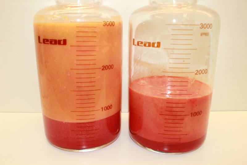 腹部・腰の脂肪吸引