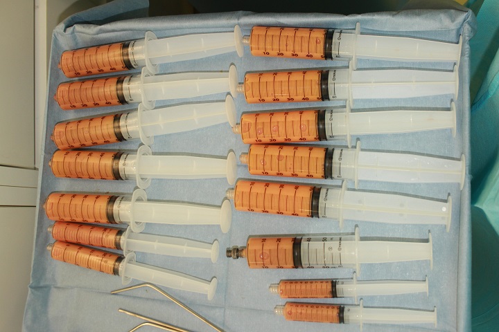 コンデンスリッチ豊胸