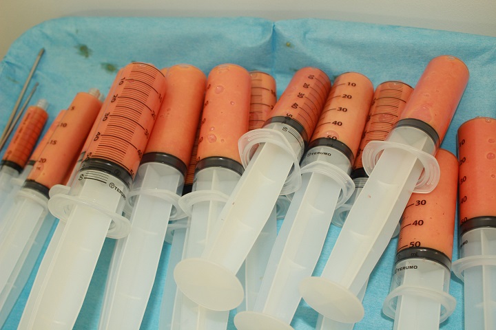 コンデンスリッチ豊胸