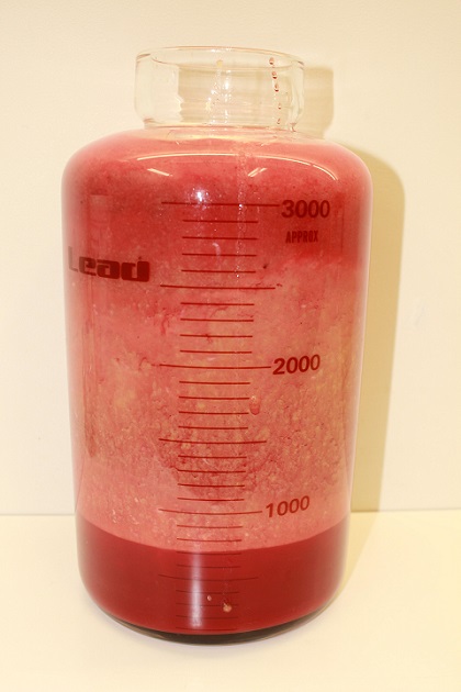 男性の脂肪吸引