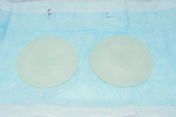 抜去したシリコンバッグ