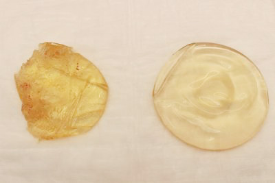 抜去したシリコンバッグ