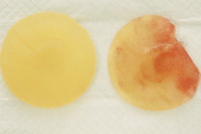 抜去したシリコンバッグ