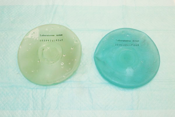 抜去したシリコンバッグ