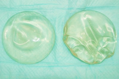 抜去したシリコンバッグ