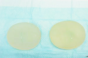 抜去したシリコンバッグ