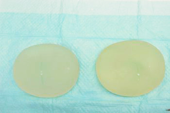 抜去したシリコンバッグ