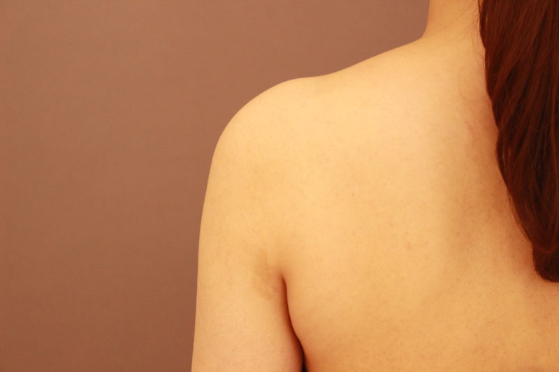 ノースリーブが似合うライン