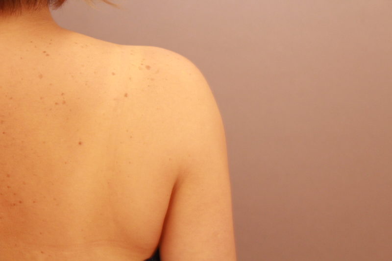 ノースリーブが似合う二の腕に