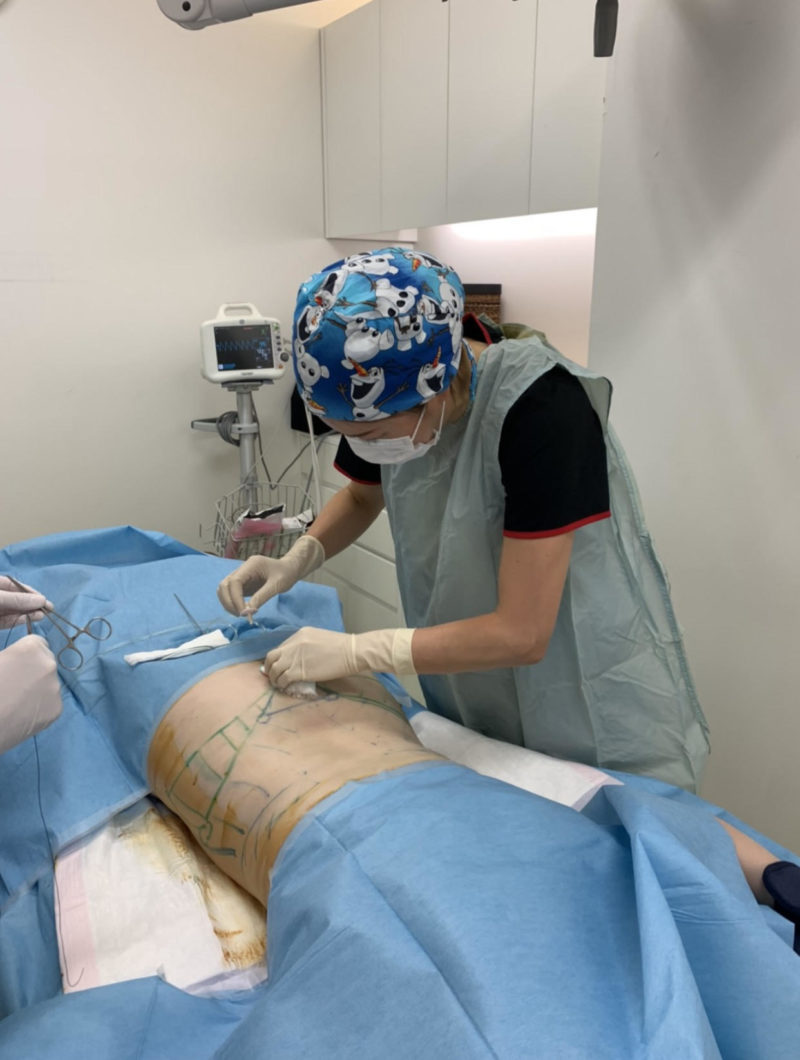 カービーライン