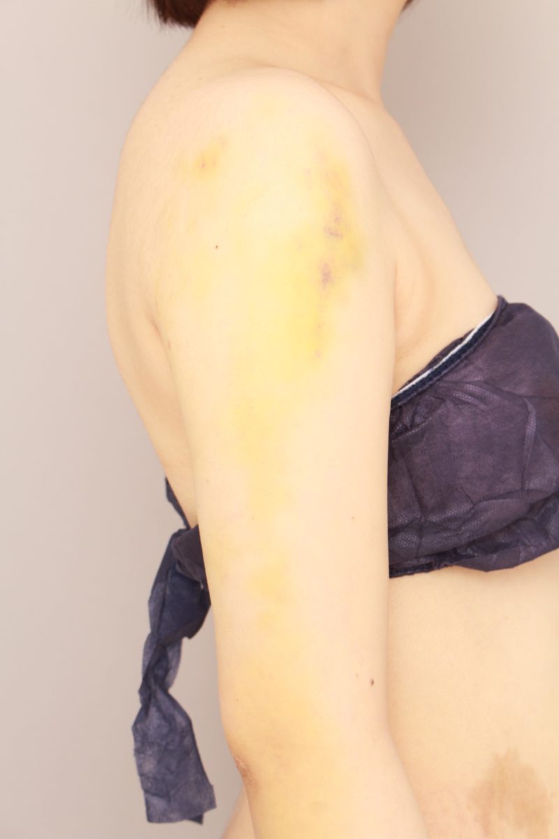 1週間後はどんな感じ?