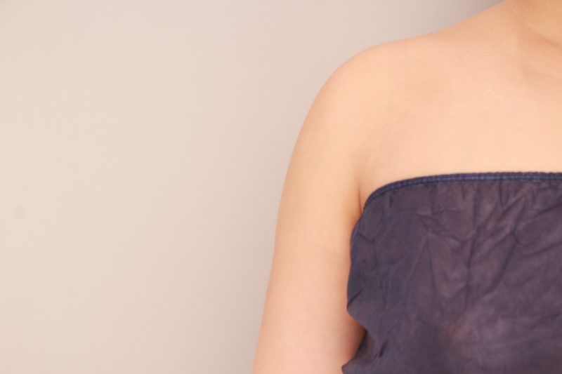 二の腕、肩の脂肪吸引1か月後