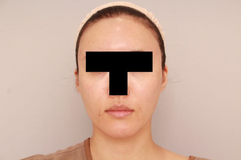 コンデンスリッチフェイスでエイジングケア