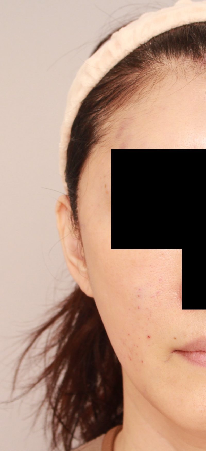 コンデンスリッチフェイスでエイジンケア