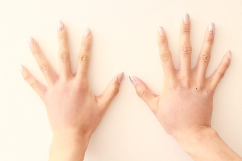 ハンドのエイジングケア!コンデンスリッチファット注入