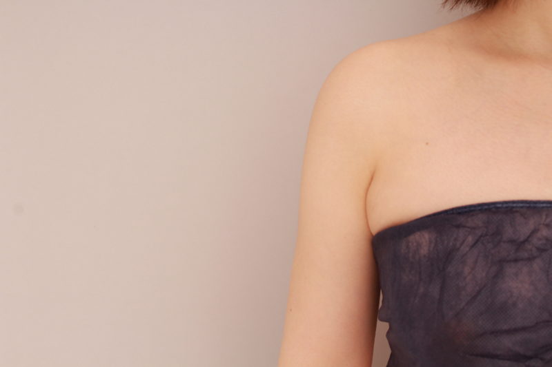 二の腕、肩の脂肪吸引1か月後