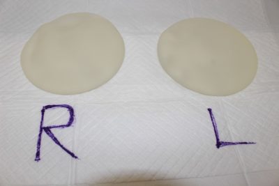 抜去したシリコンバッグ