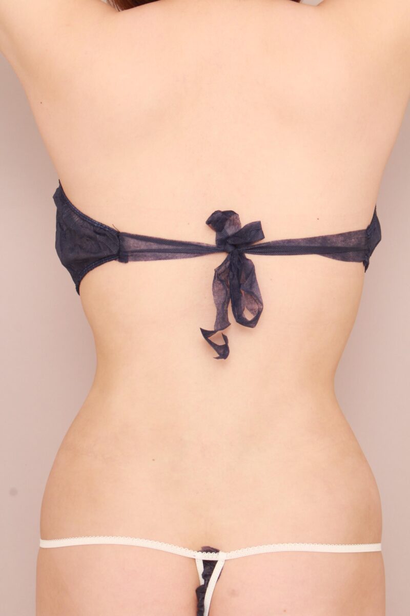 みんなで目指そう峰不二子♡お腹、腰の脂肪吸引3か月後