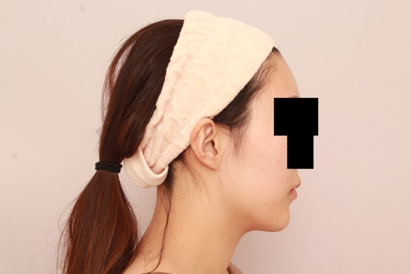 輪郭を整えて、小顔に♡