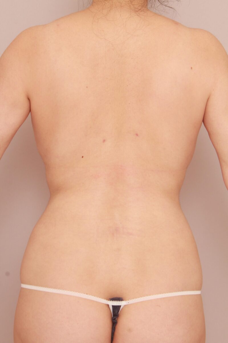 みんなで目指そう峰不二子♡背中美人へ