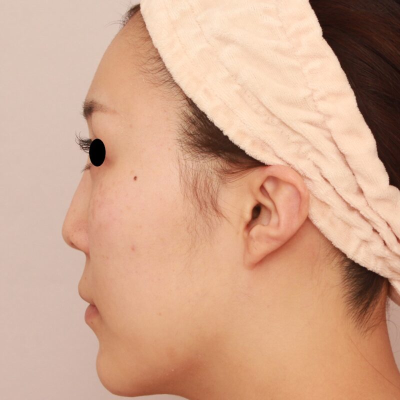 横顔の曲線のついて