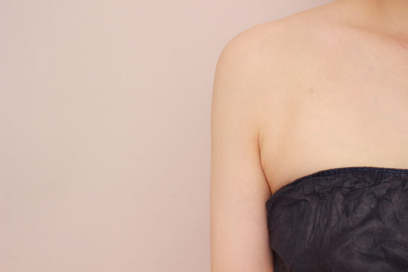 昨日の方の二の腕、肩の変化です♪