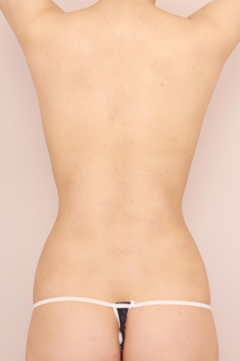 昨日のモニター様の後姿の変化です