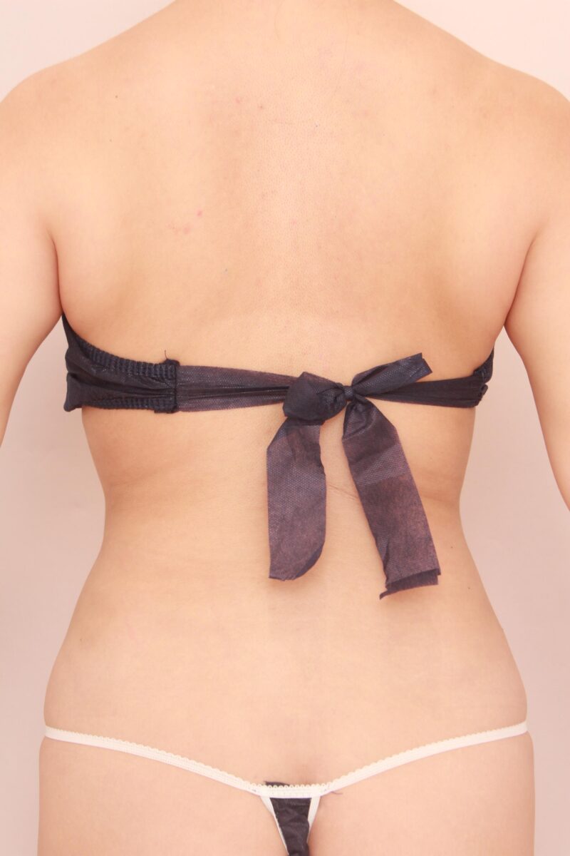 旦那様が大喜びなクビレ♡お腹全体胸下腰の脂肪吸引2か月後