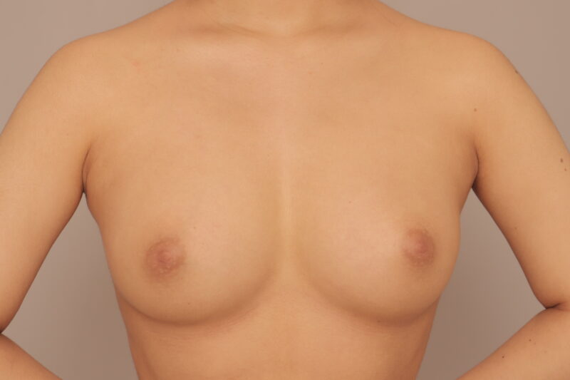 昨日のモニター様のバストの変化♡