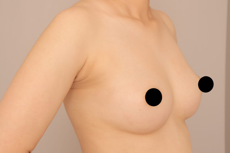 20代授乳経験無しのバストのモニター様♡