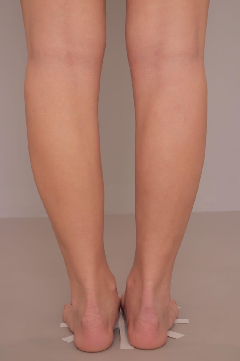 昨日のモニター様の下腿足首の変化♡