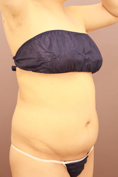 レヌビオンは使ってません・・・・