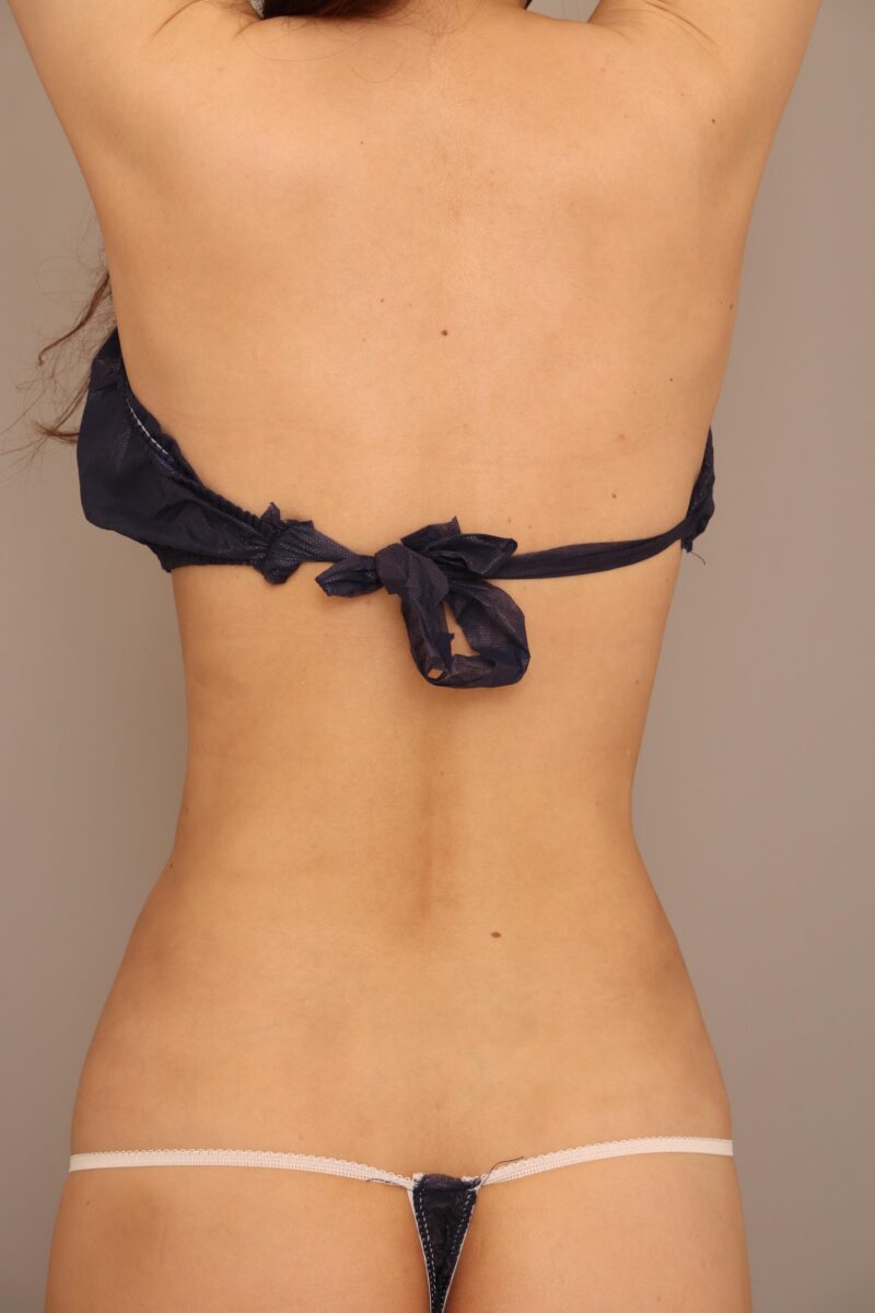 昨日の方のお腹の変化1ヶ月後♡