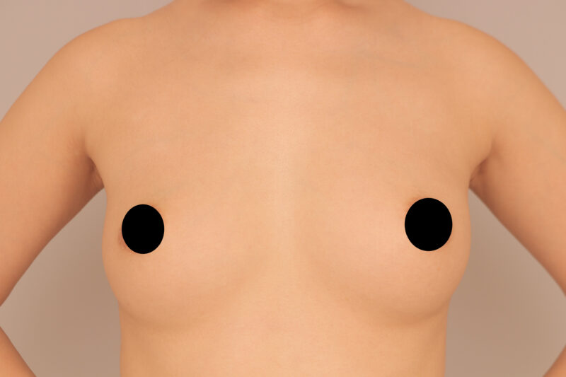 昨日のモニター様のバスト3ヶ月後♡