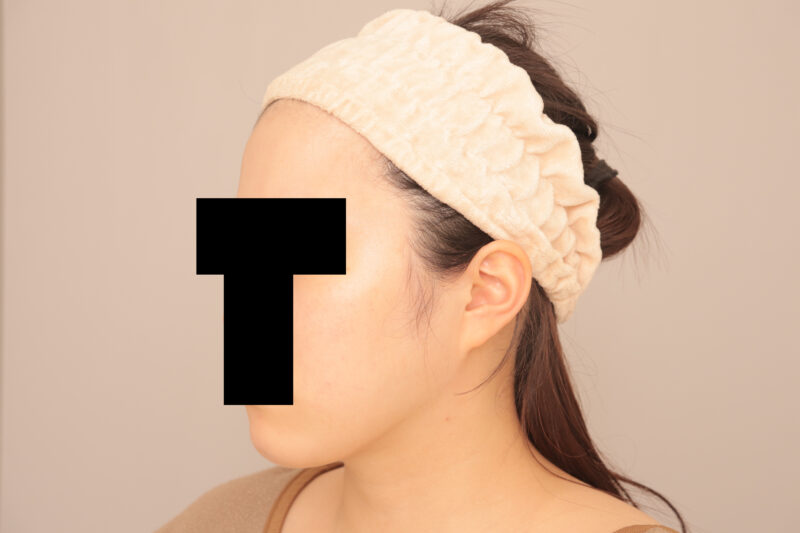 フェイスラインをしゅっとさせてますます美人さんに♡