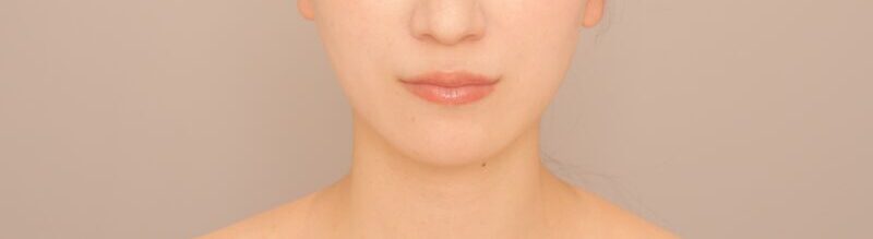 顔の左右差と輪郭が気になる　３０代前半女性