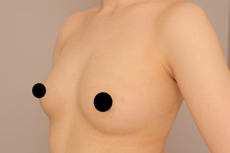 昨日のモニター様（20代授乳経験無し）の方の変化3か月後