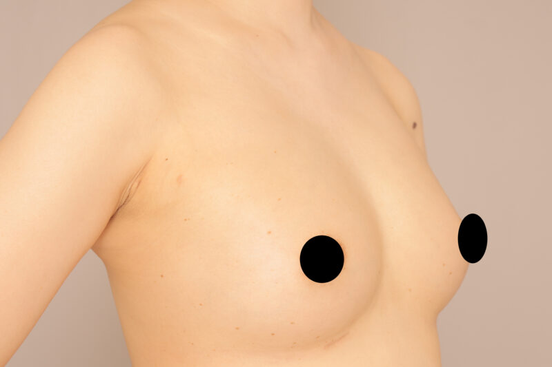 前回のモニター様のバストの変化♡