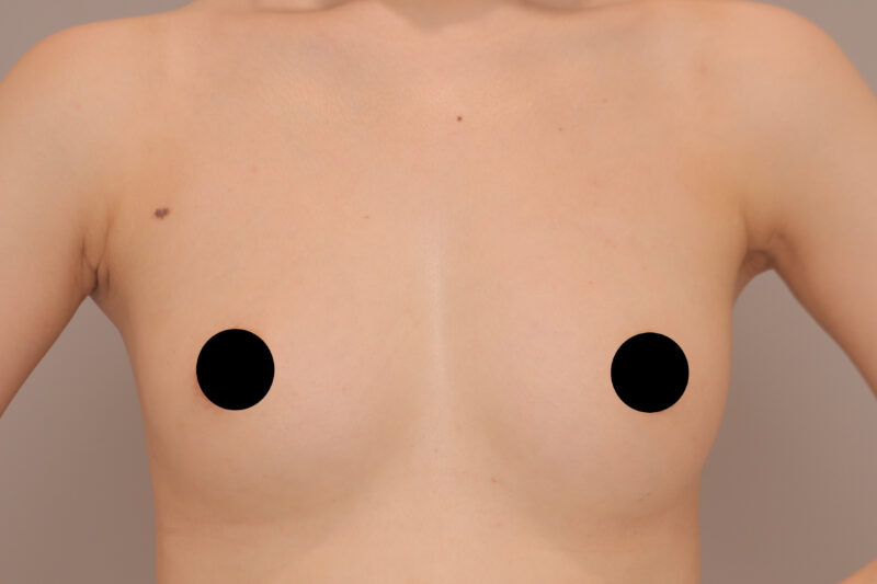 前回のポストのモニター様のバストの変化♡半年後