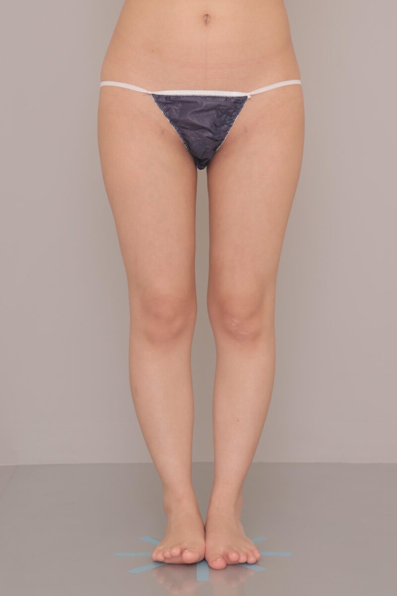 すき間を広くお尻も小さく！ ３ヶ月経過～24歳, 150cm, 46.3kg～