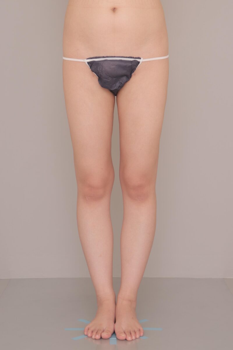 ★全方向死角なし ６ヶ月経過～23歳, 156cm, 50.5kg～