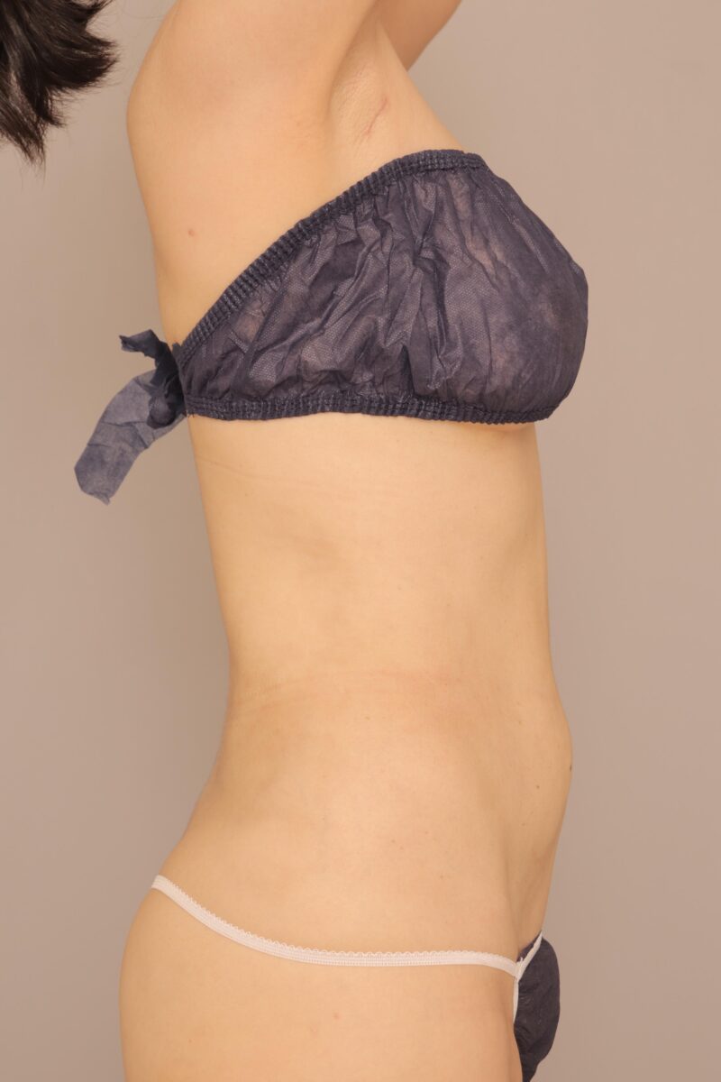 前回のモニター様のお腹の変化3ヶ月後