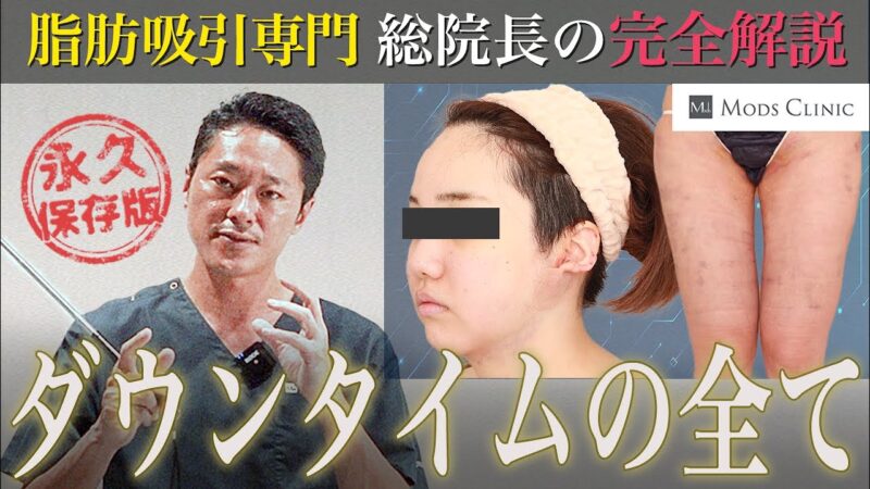 ダウンタイムについて解説しました。