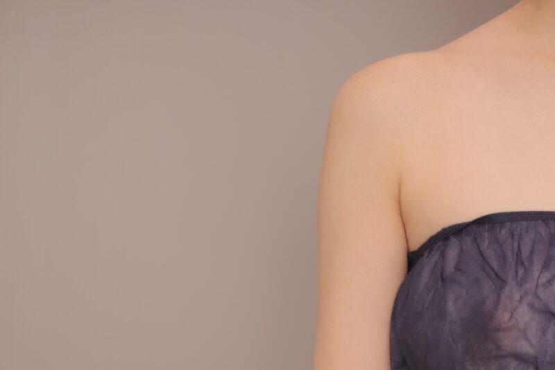 二の腕肩の脂肪吸引3ヶ月後♡