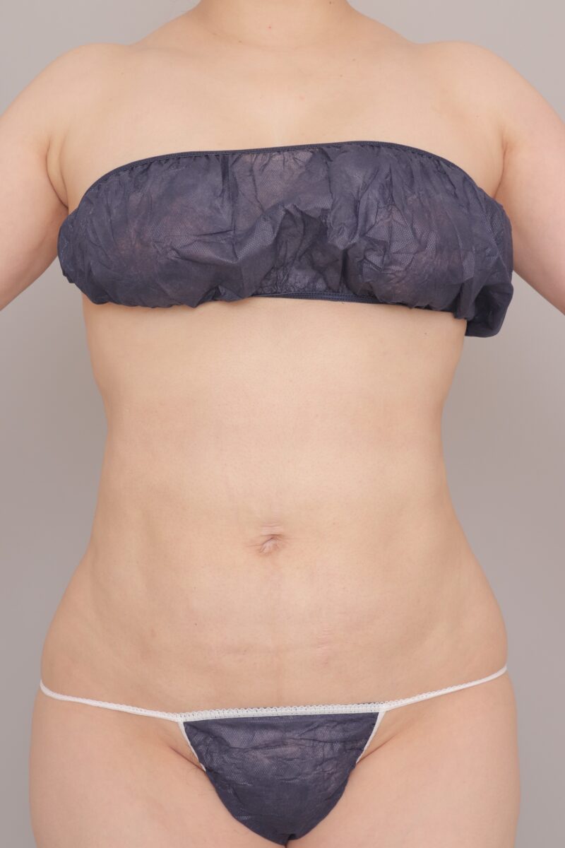 大量吸引で別人級！ ３ヶ月経過～42歳, 156cm, 62.4kg～